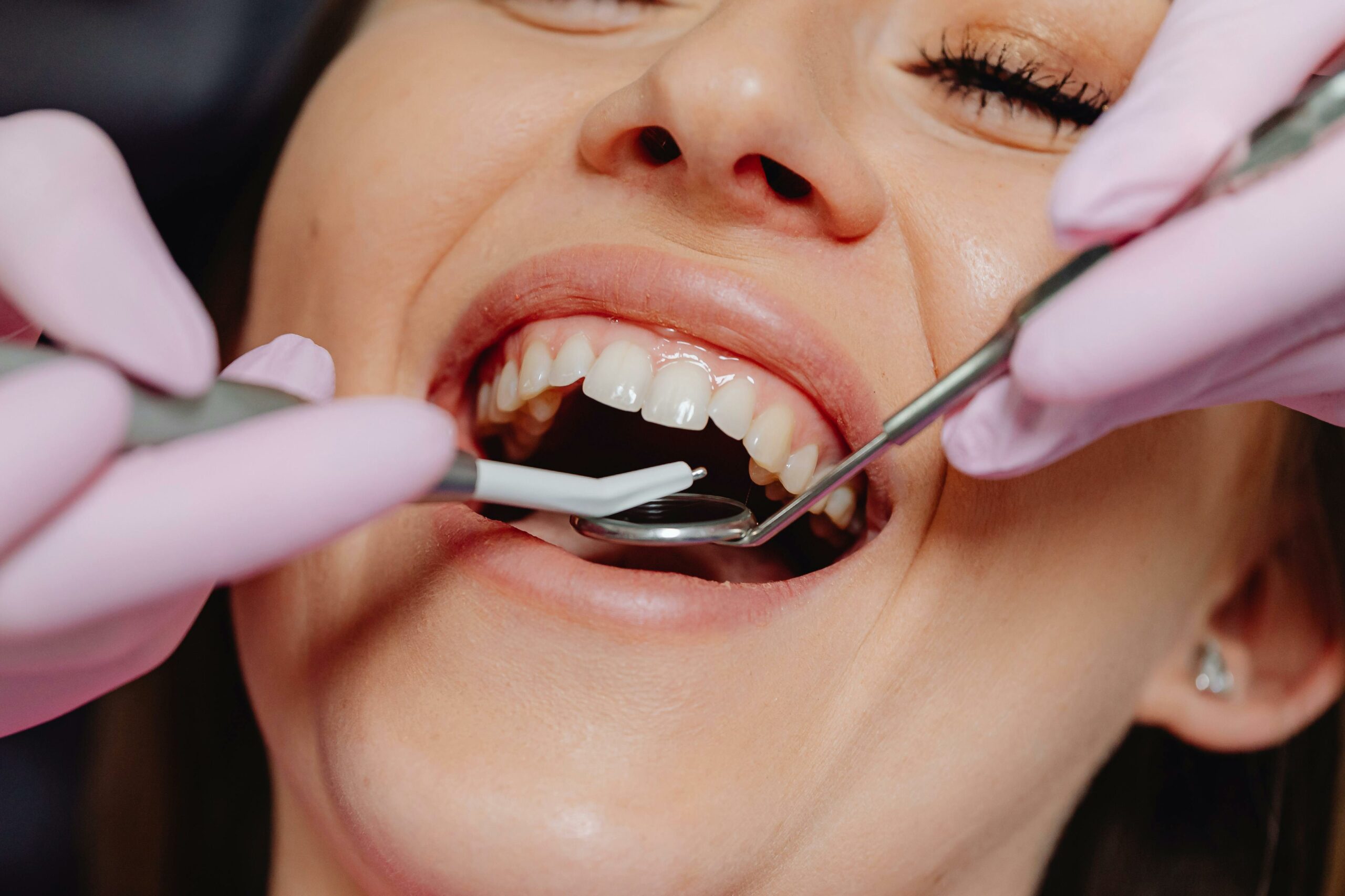 Recognizing the Silent Threat: Learn the Surefire Signs of Gum Disease